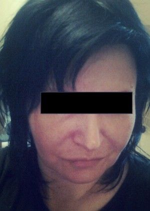 45-year-old busty nurse